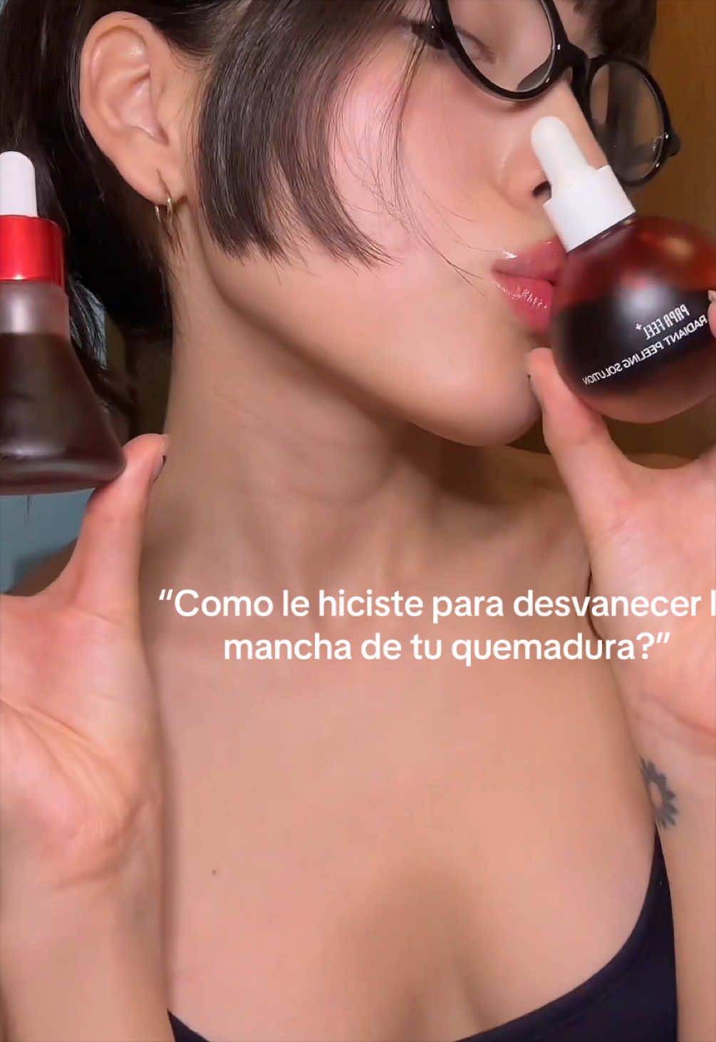 « Comment as-tu réussi à atténuer ta marque de brûlure ? TikTok video