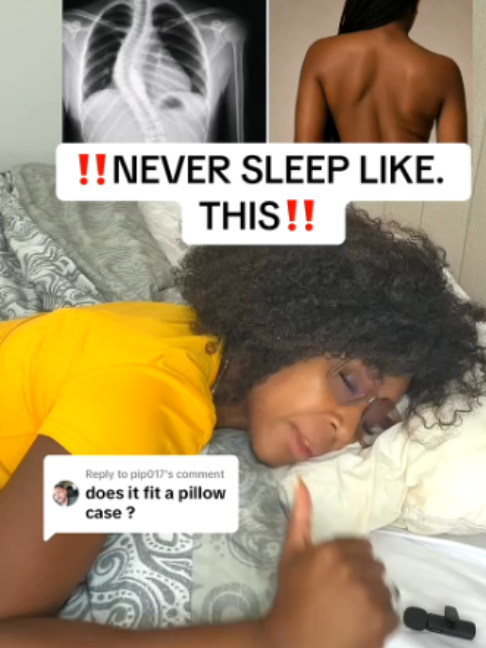 If you sleep like this your back's gonna end up looking like this, and if you sleep… TikTok video