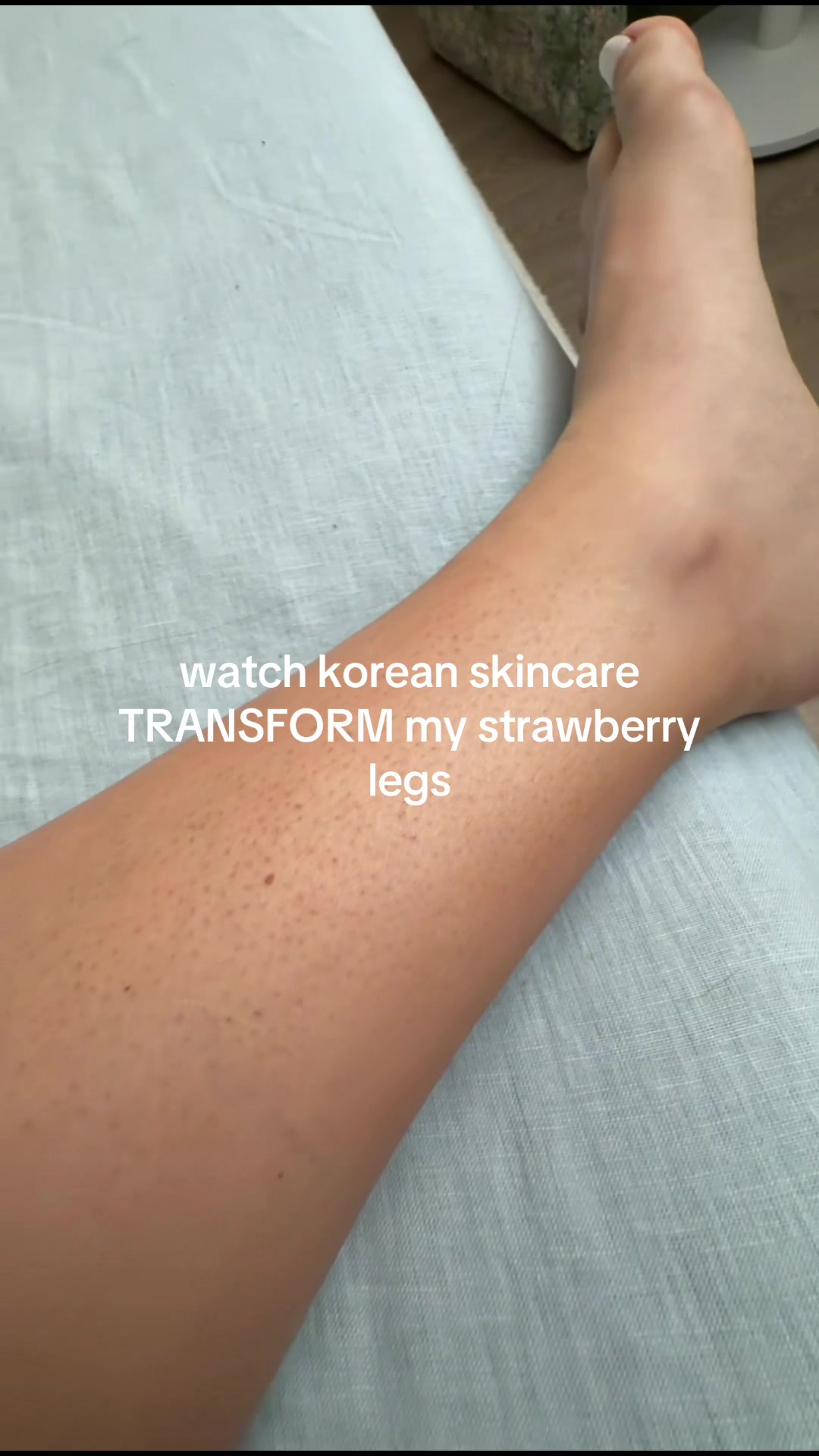 Watch korean skincare TRANSFORM my strawberry legs literally so smooth consistency… TikTok video