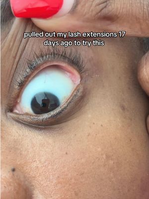 Pulled out my lash extensions 17 days ago to try this individual results may vary TikTok video