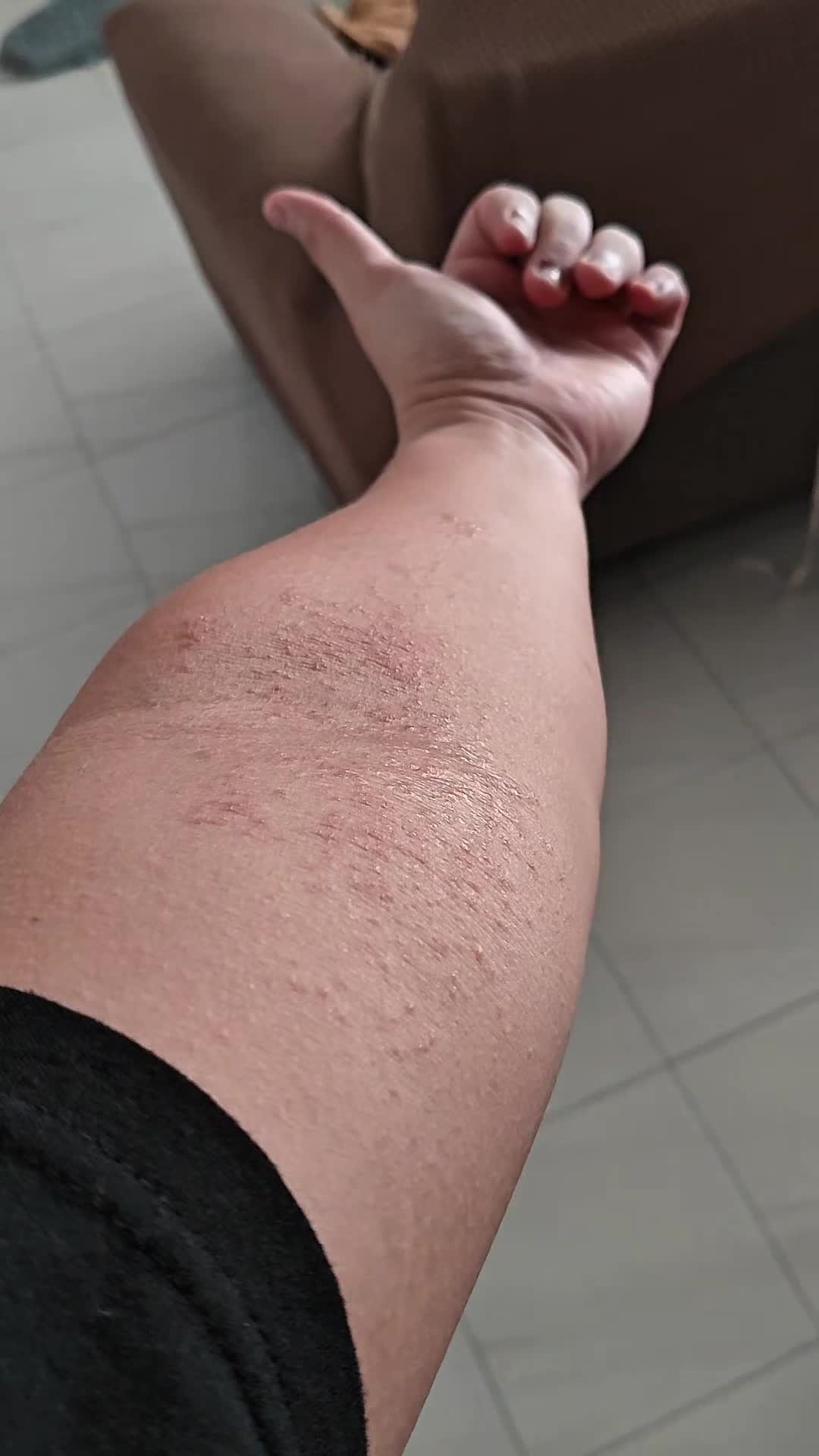 Viewer Discretion is advised The upcoming content may contain disturbing skin… TikTok video