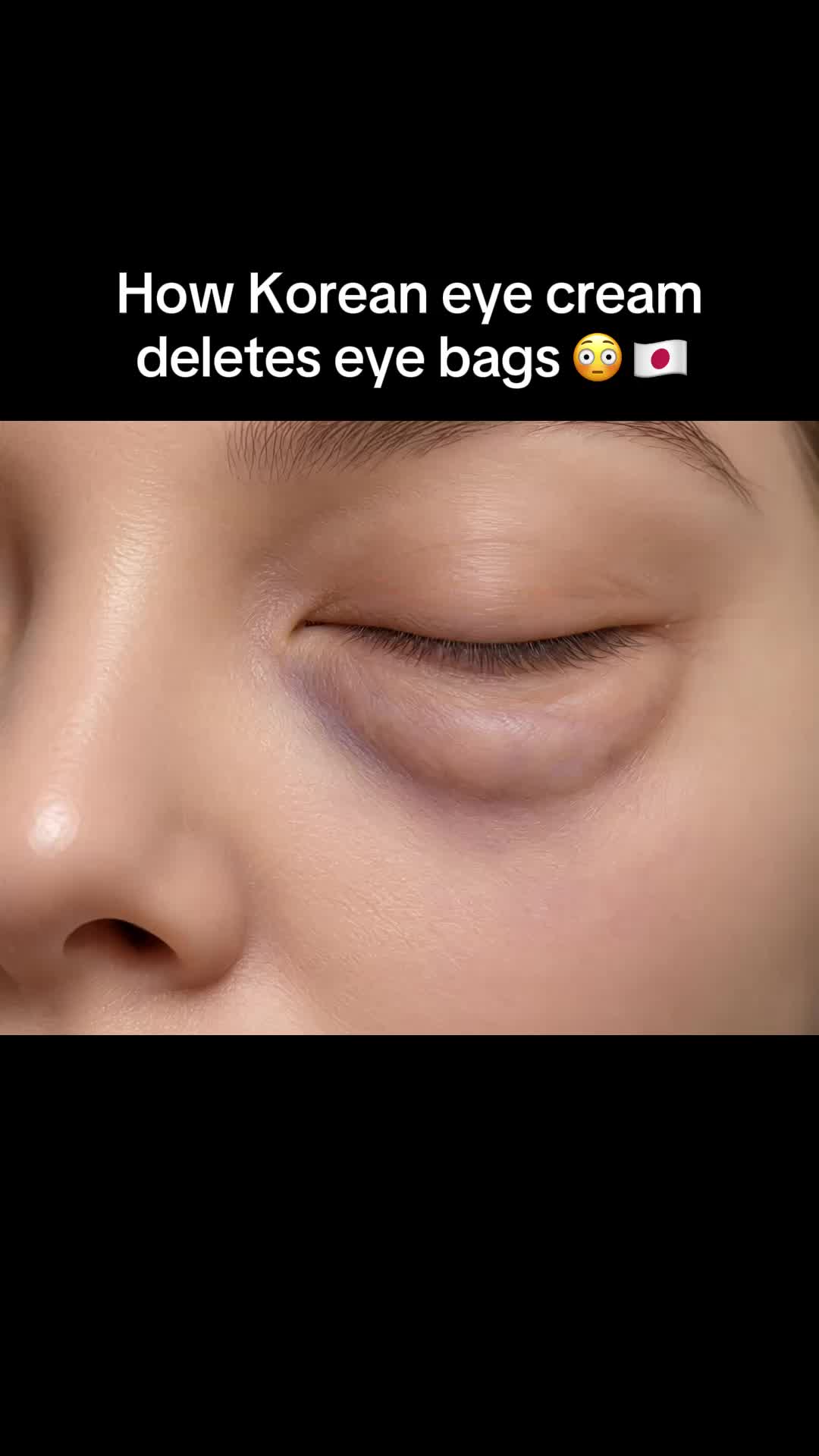 How Korean eye cream deletes eye bags 😳 🇯🇵 TikTok video
