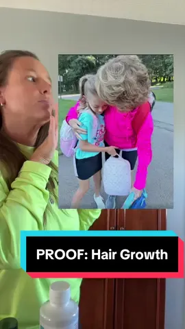 Ladies, if you're on a hair growth journey, this is my mom one year ago. TikTok video