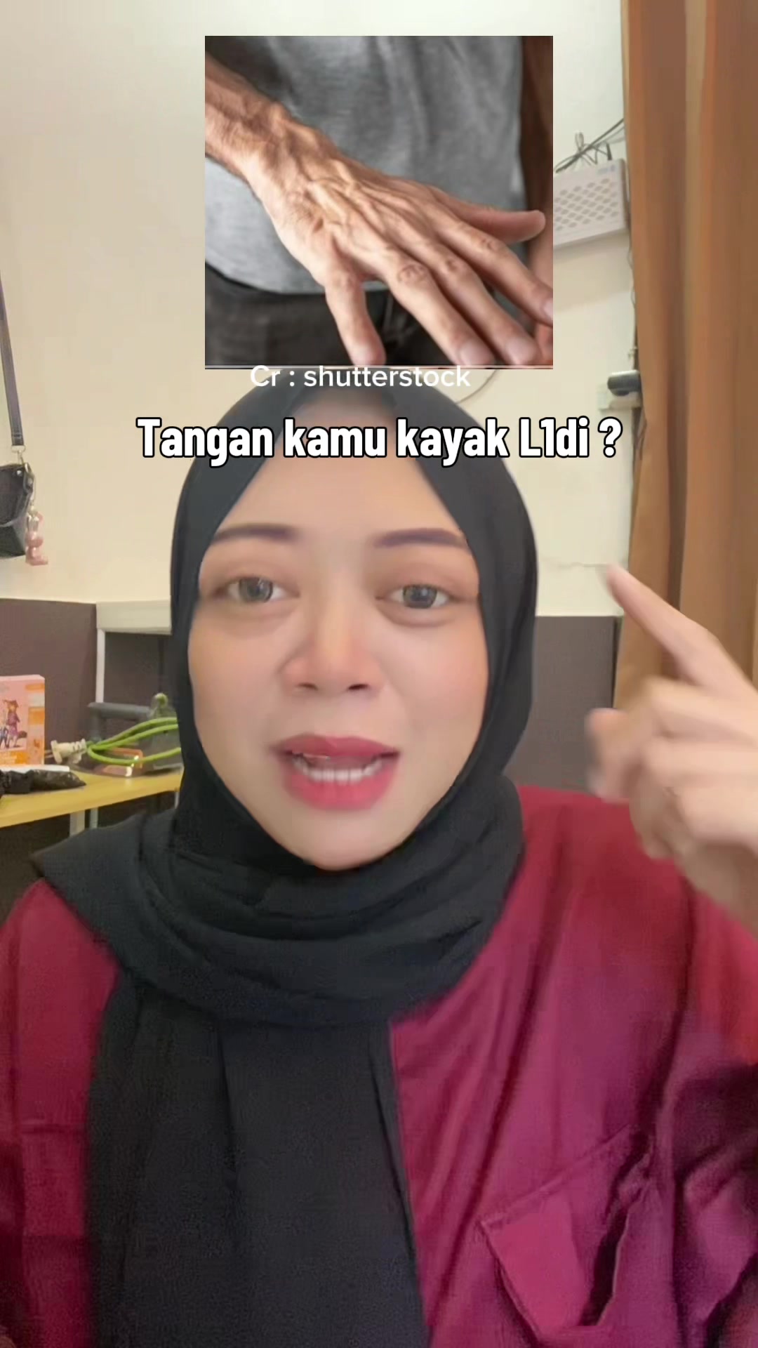 Are your hands like that? TikTok video