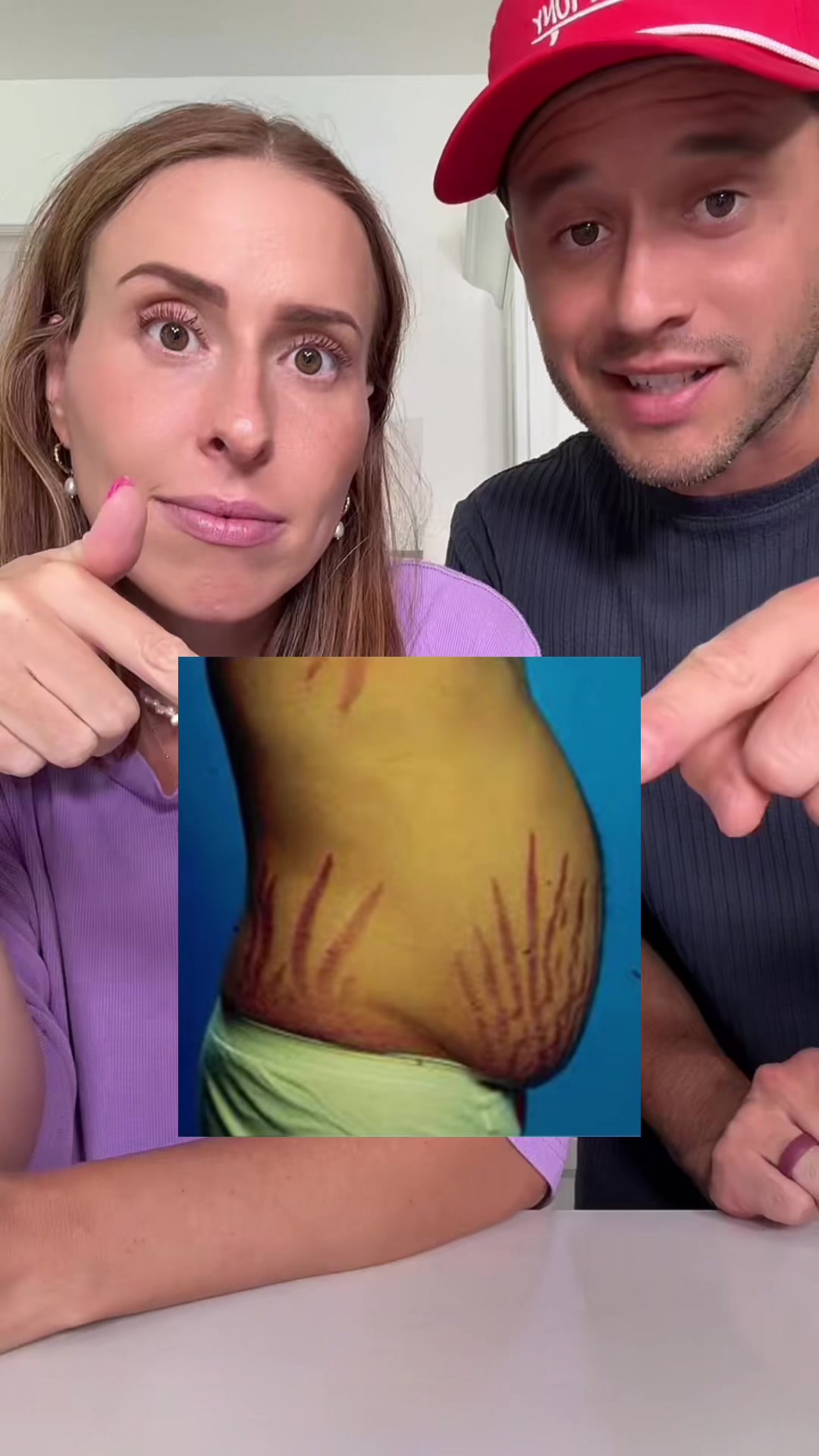 This is high cortisol. TikTok video