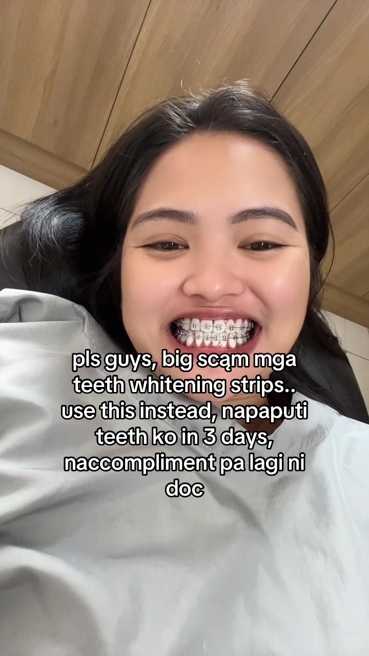 Les amis, ces bandes blanchissantes pour les dents sont une grosse arnaque TikTok video