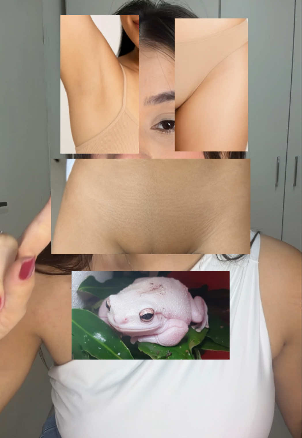 Si tu ne veux pas finir comme ça, n'utilise ni acide tranexamique ni niacinamide TikTok video