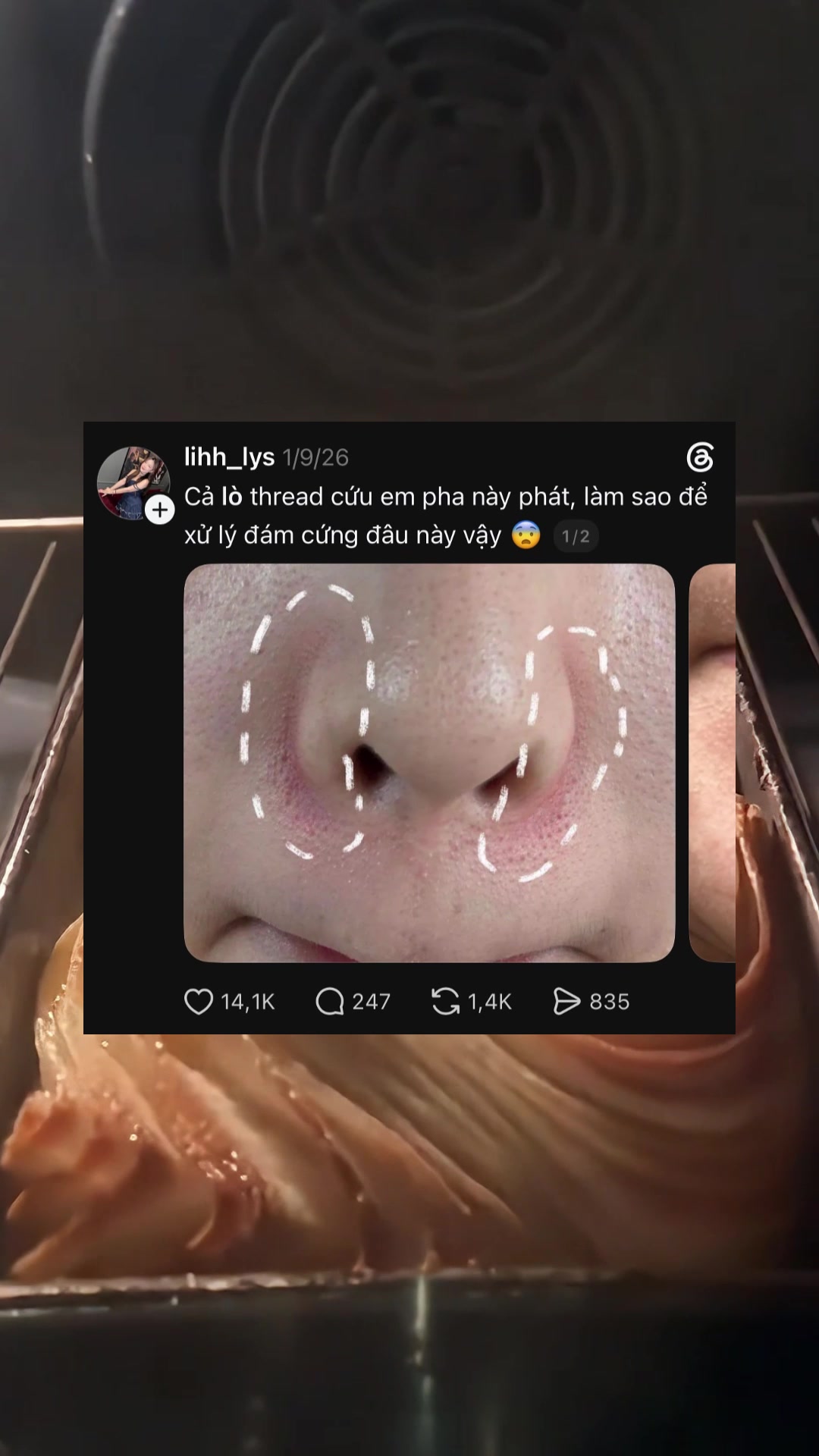 피부 고민을 구해준 스레드, 막힌 모공은 어떻게 관리할까? TikTok video