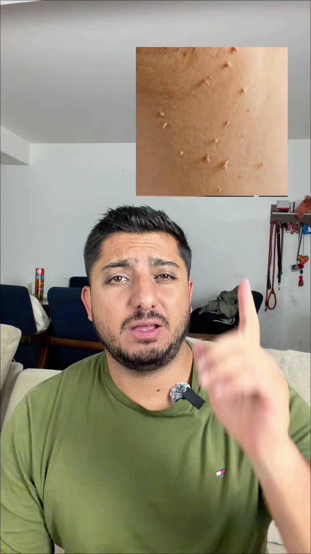 This is high cortisol. TikTok video