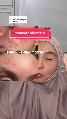 Me entristece ver así la cara de mi hijo. TikTok video