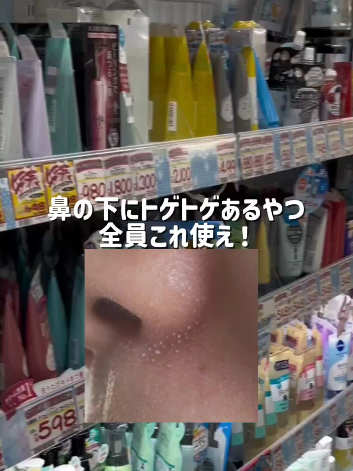 Everyone with bumps under your nose use this! TikTok video
