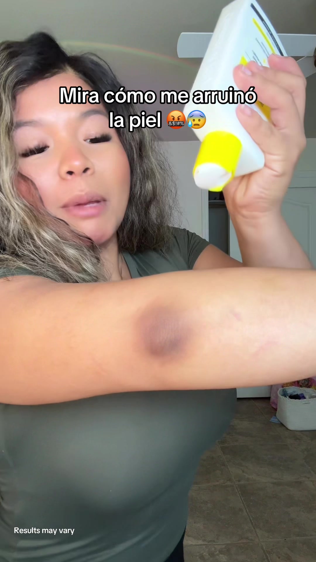 Look how it ruined my skin TikTok video