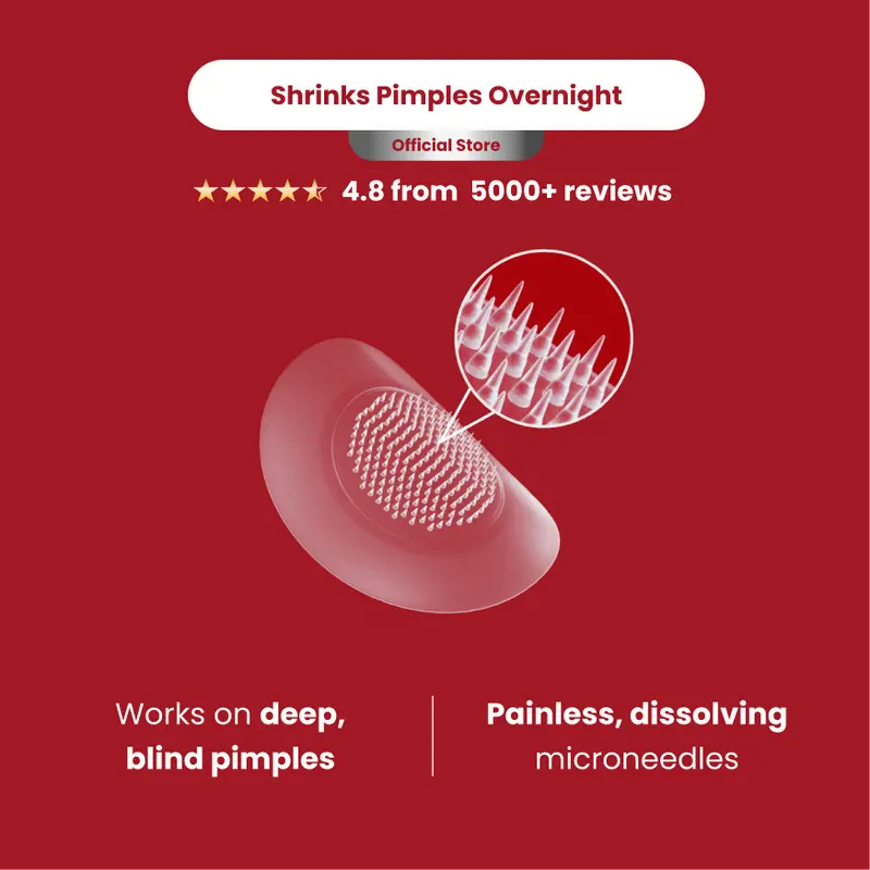 ClearUp Microdart Acne Patches for Blind Pimples with Pure Hydrocolloid