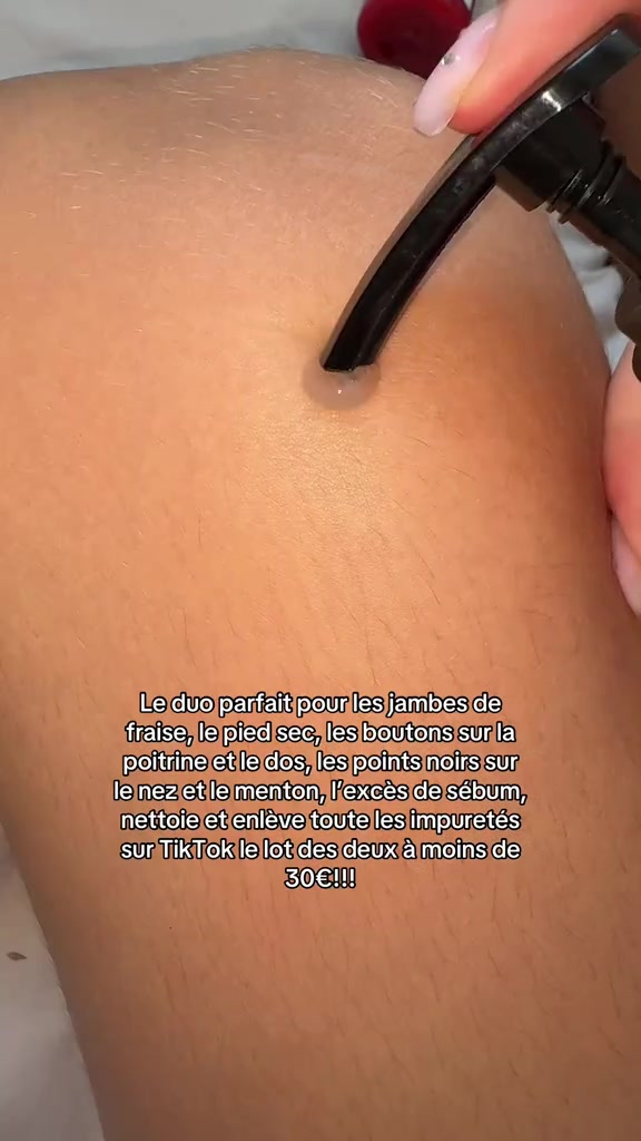 分镜拆解 2